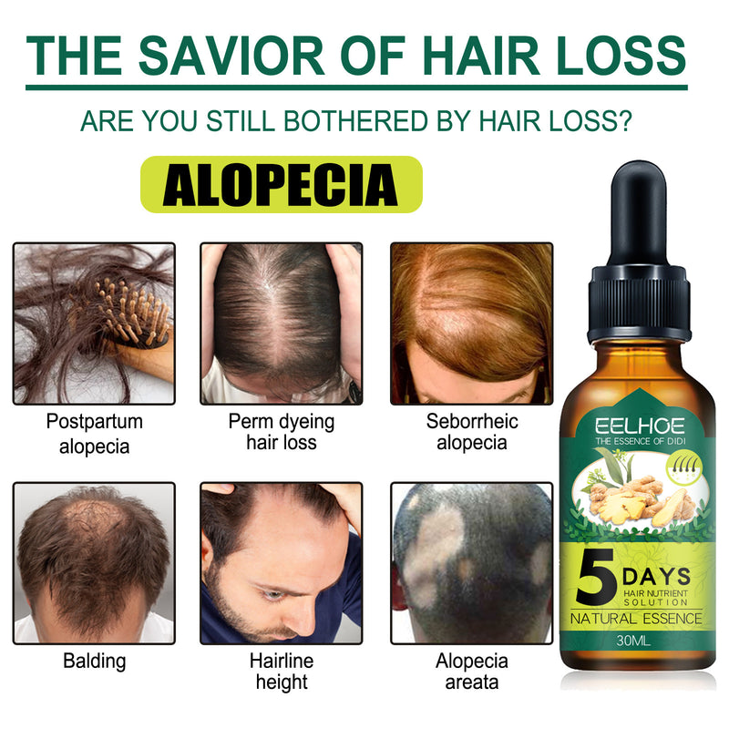 EELHOE Rosemary Hair Oil – Anti-Breakage, Growth & Scalp Care