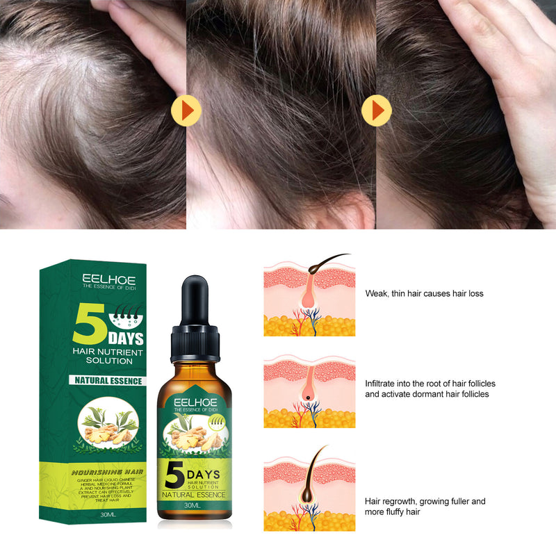 EELHOE Rosemary Hair Oil – Anti-Breakage, Growth & Scalp Care